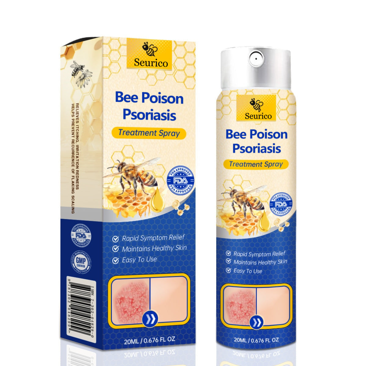 ✨【 official Brand Store】 Last Day Discount: 83% OFF 🌸 Seurico™ PsoriaHeal psoriasis Spray pro