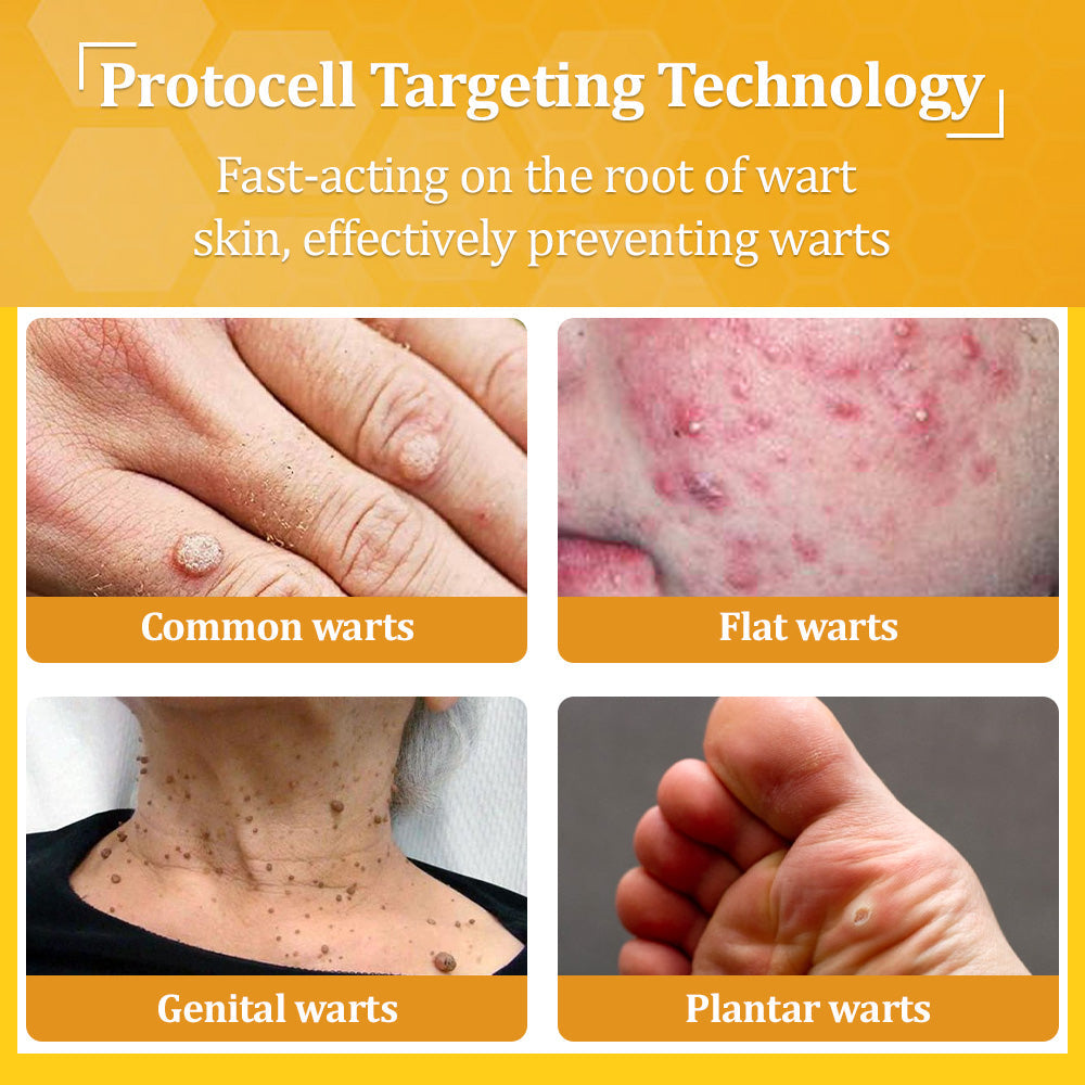 🐝🥇Seurico™ TagCure Bee Venom Cream — Certified by the American Association of Dermatologists (AAD), strong & fast removal of warts, growths & keratosis