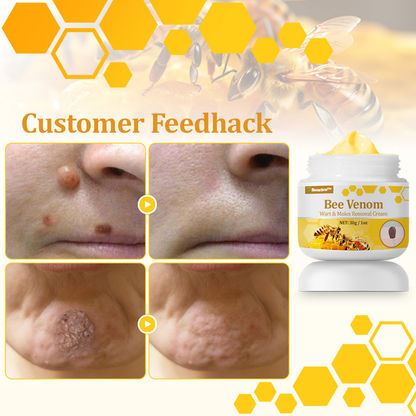 🐝🥇Seurico™ TagCure Bee Venom Cream — Certified by the American Association of Dermatologists (AAD), strong & fast removal of warts, growths & keratosis