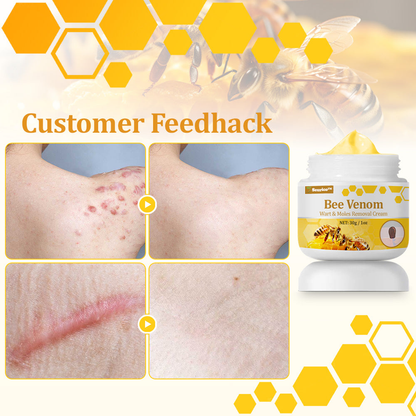 🐝🥇Seurico™ TagCure Bee Venom Cream — Certified by the American Association of Dermatologists (AAD), strong & fast removal of warts, growths & keratosis