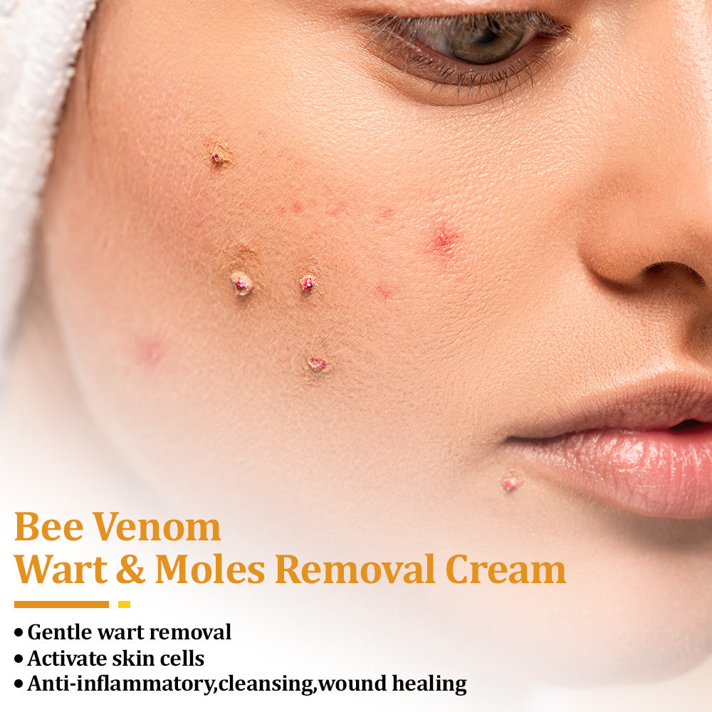 🐝🥇Seurico™ TagCure Bee Venom Cream — Certified by the American Association of Dermatologists (AAD), strong & fast removal of warts, growths & keratosis