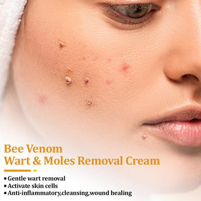 🐝🥇Seurico™ TagCure Bee Venom Cream — Certified by the American Association of Dermatologists (AAD), strong & fast removal of warts, growths & keratosis