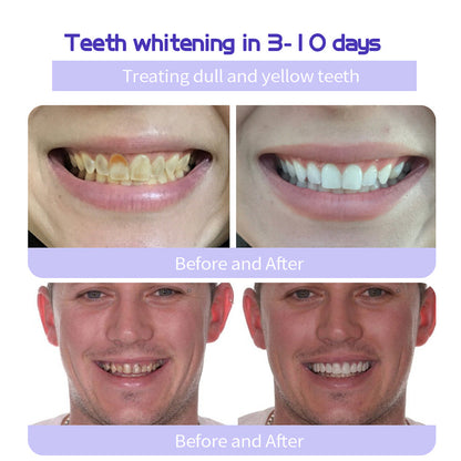 🎁Flash Sale - Don’t Miss Out - ODALIT™ TeethRestoration Mineral Powder🦷(ADA recommended)👩‍⚕️(Treats periodontitis and mouth ulcers, prevents tooth loss, and repairs gum recession)