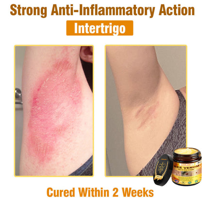 LBMLBM™ Bee Venom All-in-One Cream US Dermatologist Approved