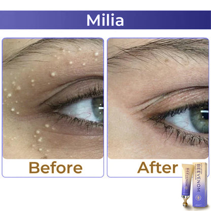 ✨ ODALIT™ Collagen+ Bee Venom Roller Eye Cream 🇦🇺 Dermatologist Approved