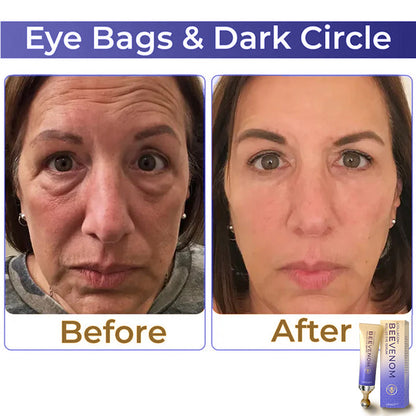 ✨ ODALIT™ Collagen+ Bee Venom Roller Eye Cream 🇦🇺 Dermatologist Approved