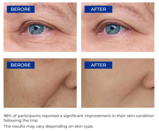 🎁Flash Sale - 💟 ODALIT™ Retinol Pro Repair Serum 🔥 LAST DAY 49% OFF 💎💎
