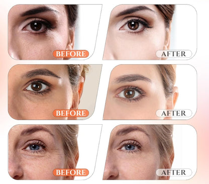 🎁Flash Sale - 💟 ODALIT™ Retinol Pro Repair Serum 🔥 LAST DAY 49% OFF 💎💎