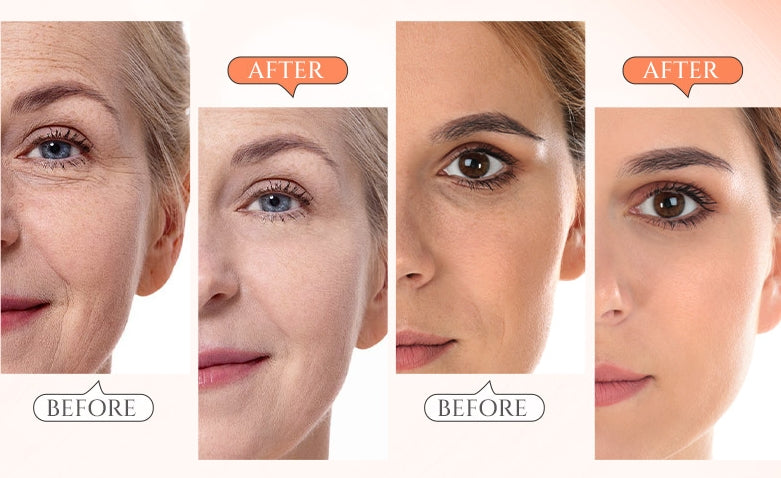 🎁Flash Sale - 💟 ODALIT™ Retinol Pro Repair Serum 🔥 LAST DAY 49% OFF 💎💎