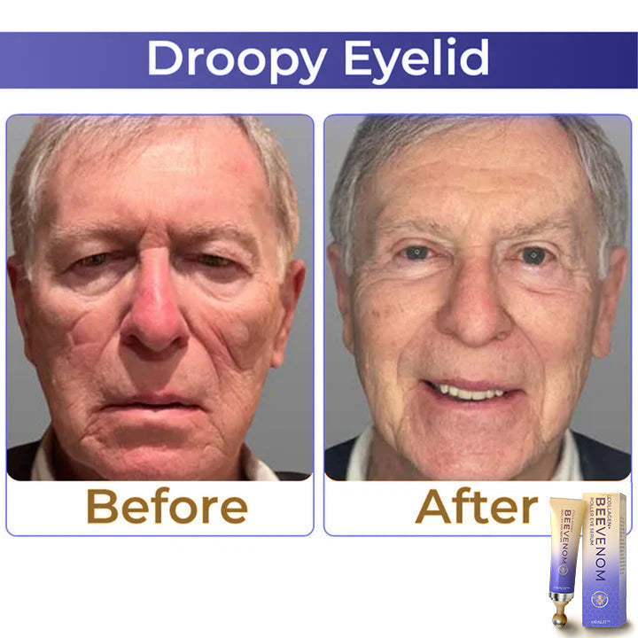 ✨ ODALIT™ Collagen+ Bee Venom Roller Eye Cream 🇦🇺 Dermatologist Approved
