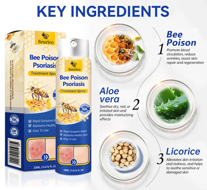 ✨【 official  Brand  Store】  Last Day Discount: 83% OFF 🌸 Seurico™ PsoriaHeal  psoriasis Spray pro