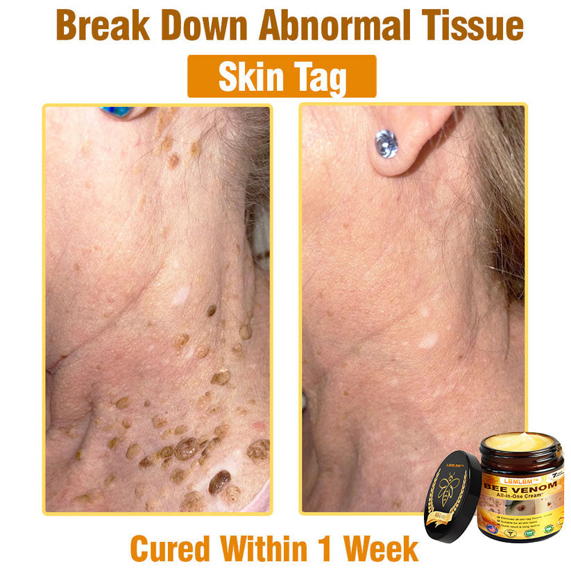 LBMLBM™ Bee Venom All-in-One Cream US Dermatologist Approved