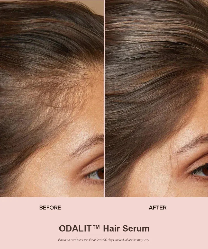 ODALIT™ Hair Serum - Clinically Proven HairRenewal for Men &Women 35+