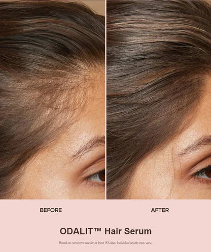 ODALIT™ Hair Serum - Clinically Proven HairRenewal for Men &Women 35+