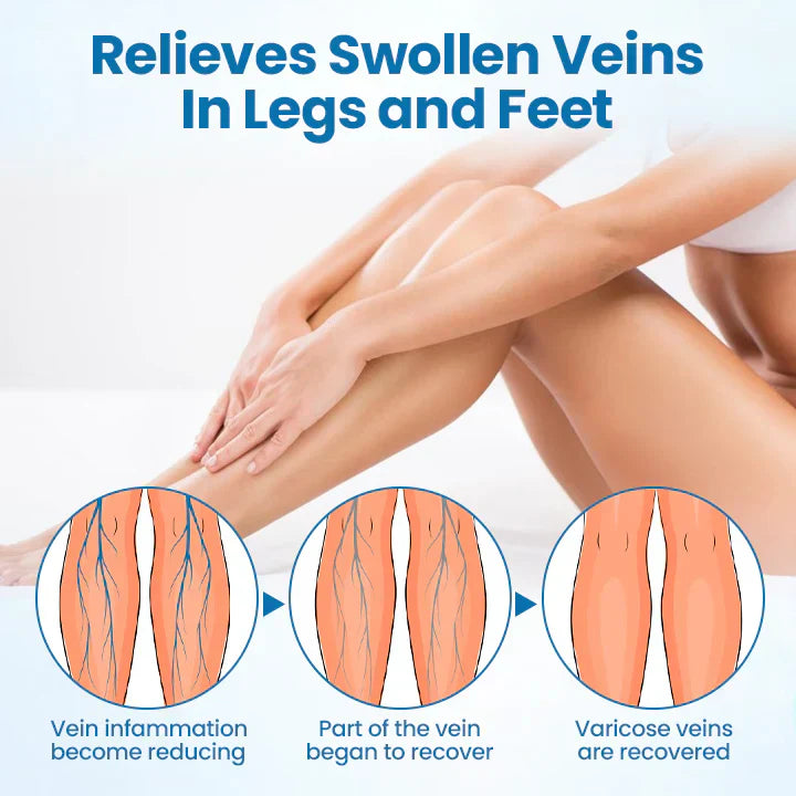 🎁Flash Sale - ODEIUN™ VeinGuard Herbal Spray-✅ Clinically proven to eliminate varicose veins in just 7 days!
