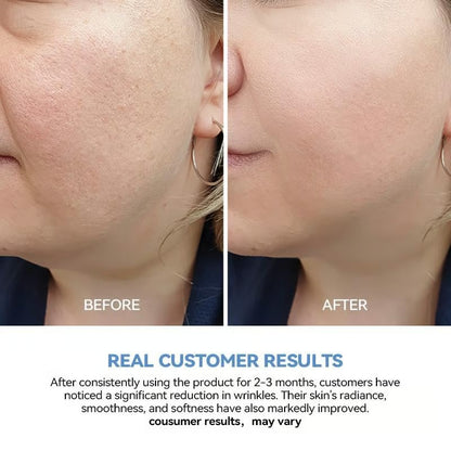 🏆Flash Sale⚡ 50K+ SOLD! Almost Gone-💥Ultra-Hydrating Serum -Vegan | 3% Hyaluronic Acid Glass Skin Single-Use Vials Skincare Comfort，，Best gifts